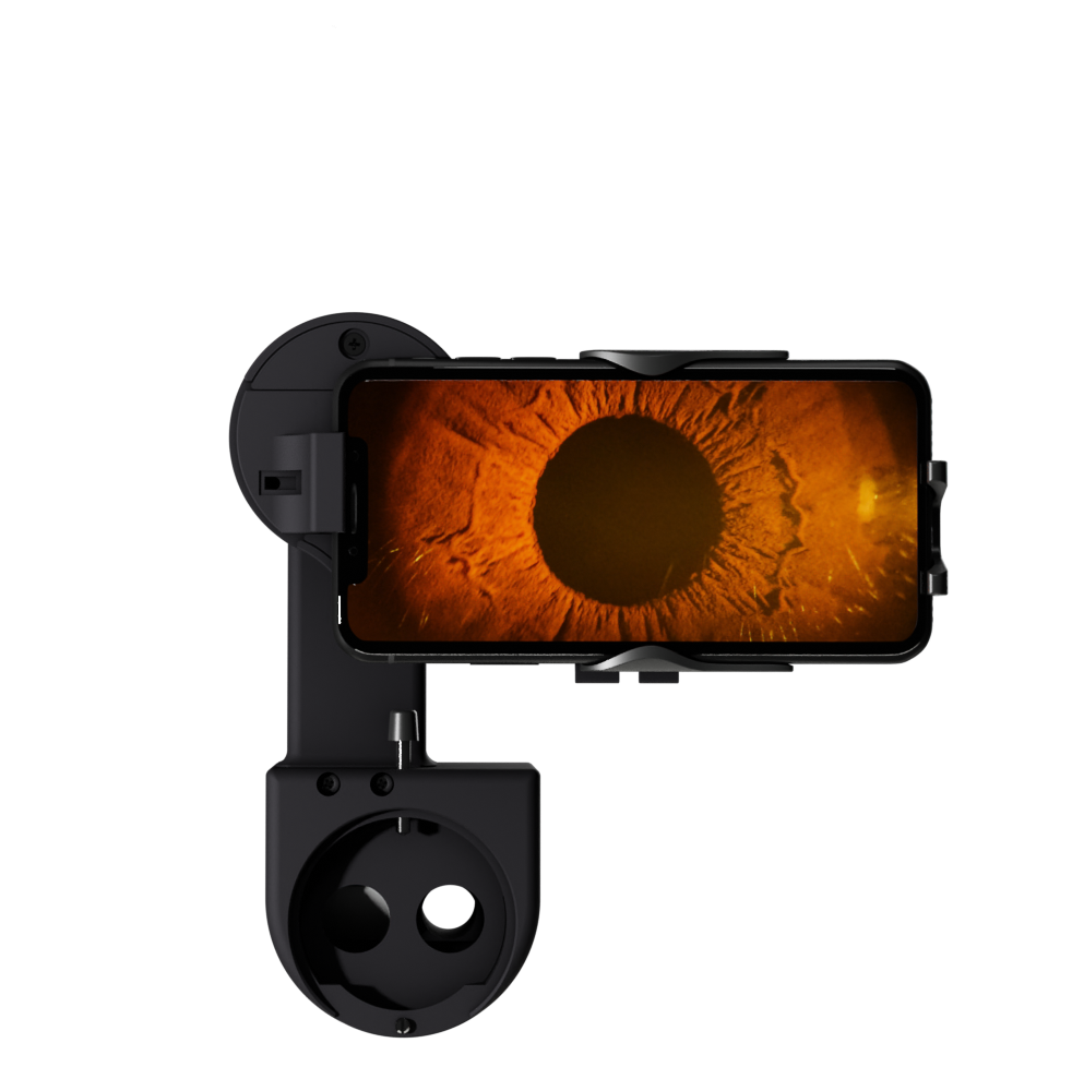 The Growing Role of Smartphone-Based Anterior Imaging in European Eye Care