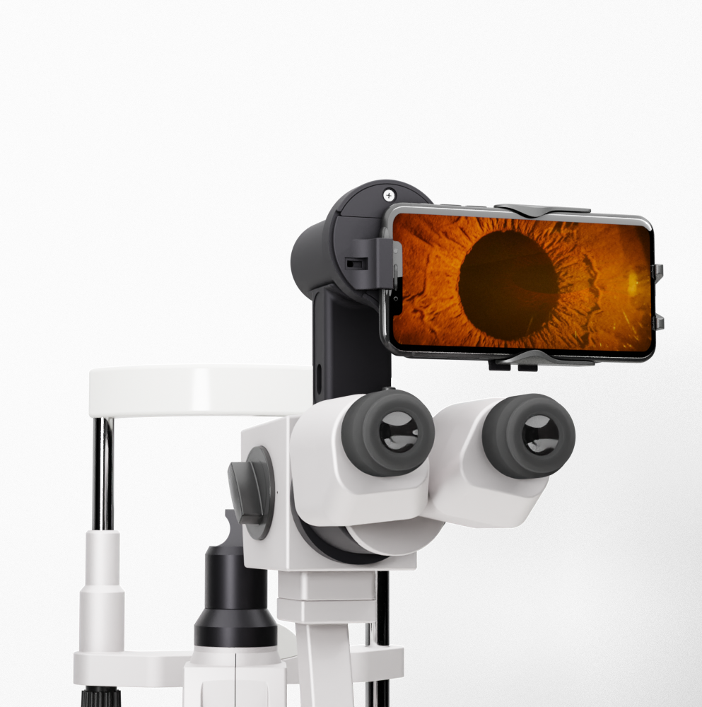 Anterior Imaging Module (AIM)