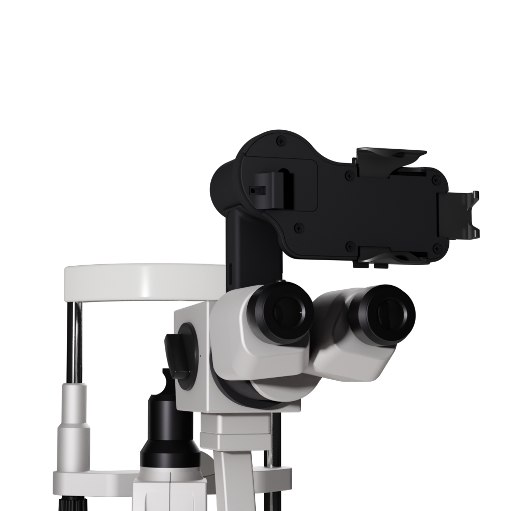 Anterior Imaging Module (AIM)