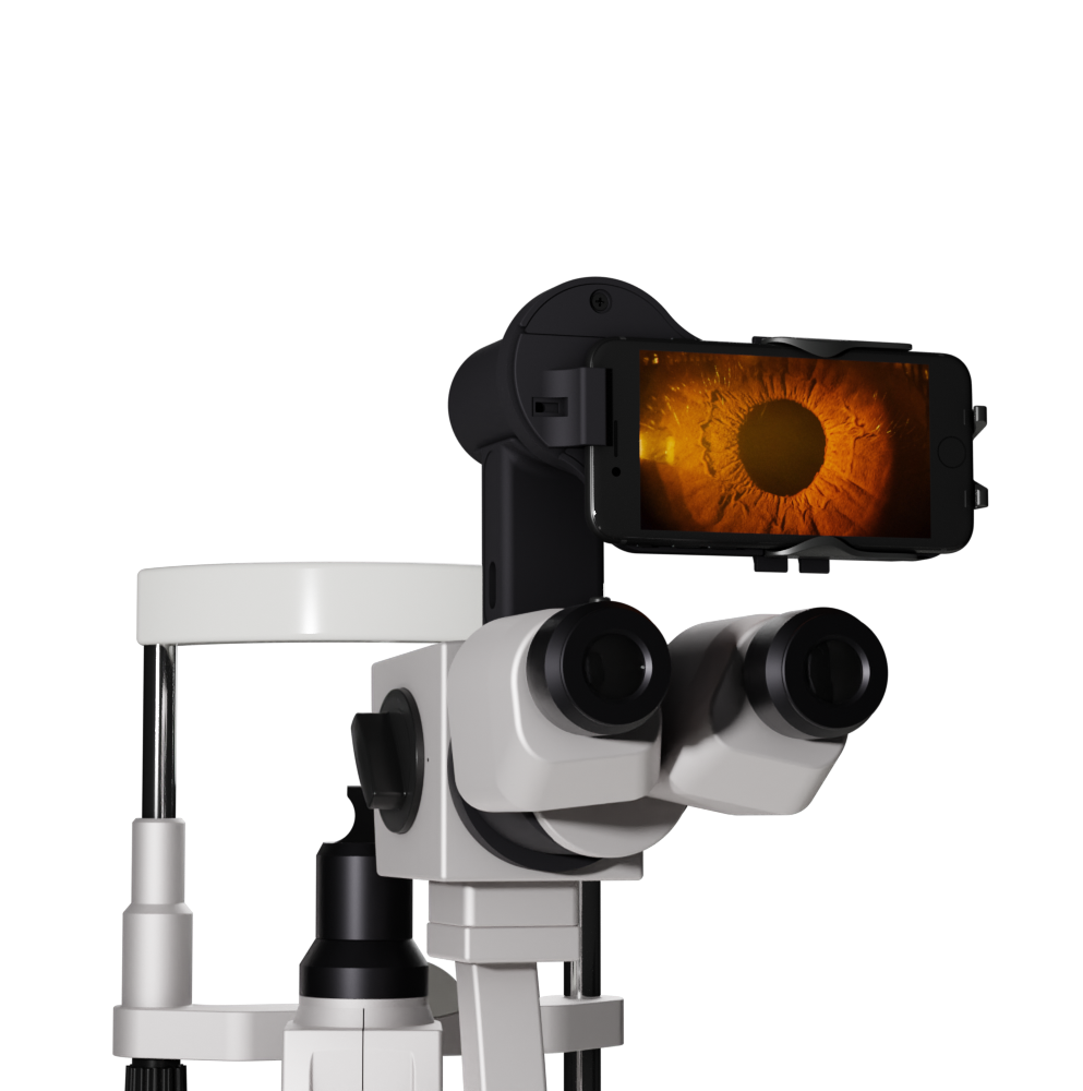 Anterior Imaging Module (AIM)