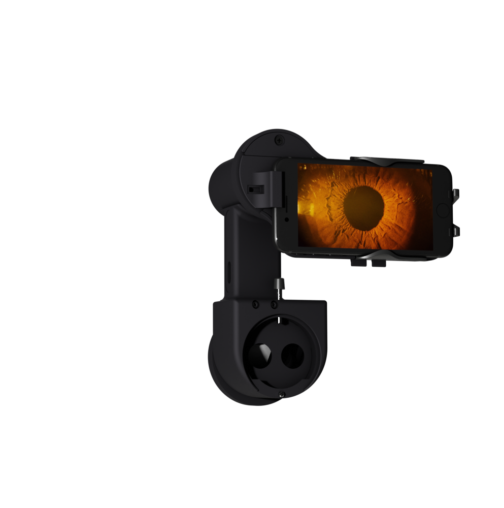 Anterior Imaging Module (AIM)