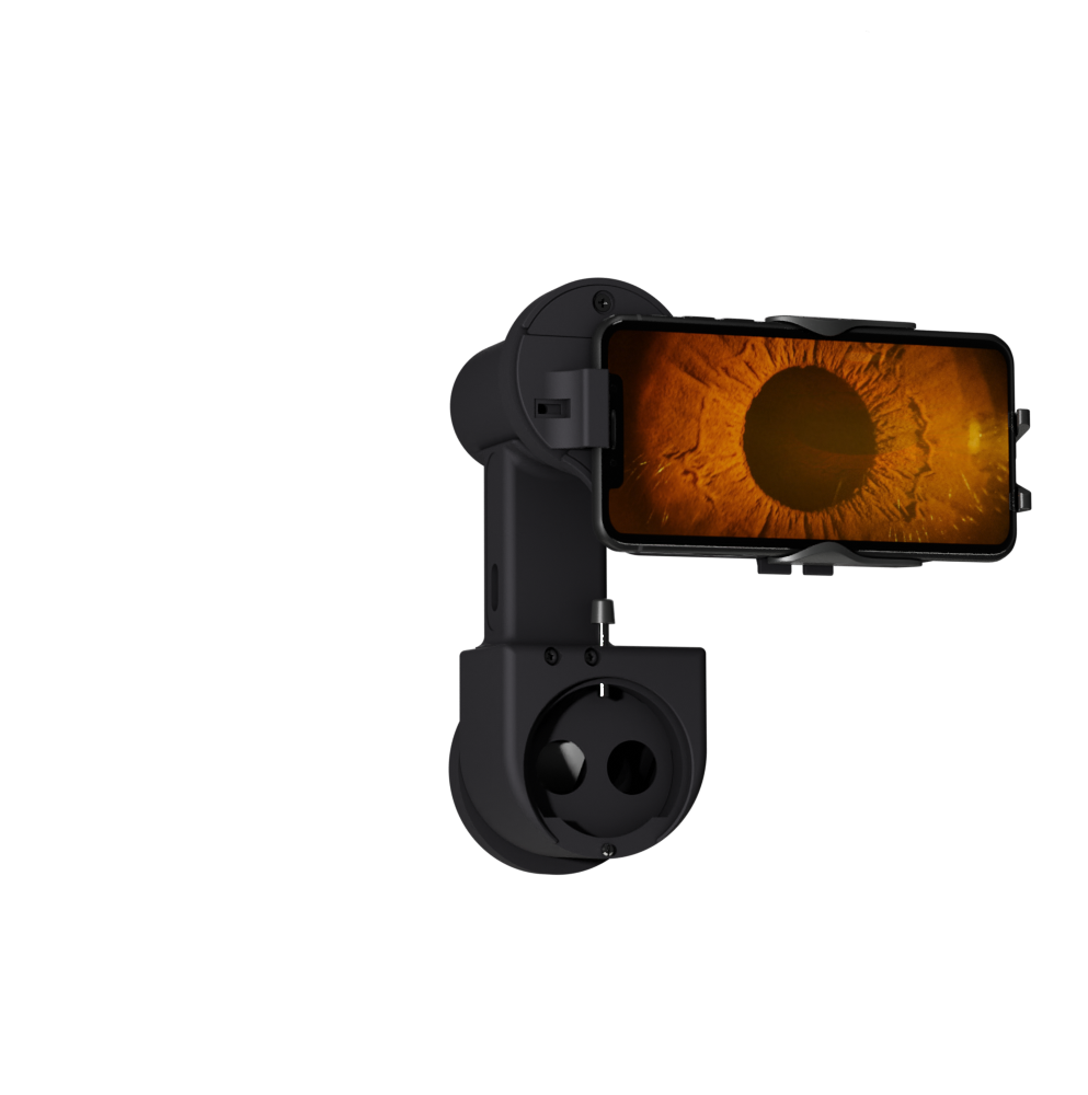 Anterior Imaging Module (AIM)