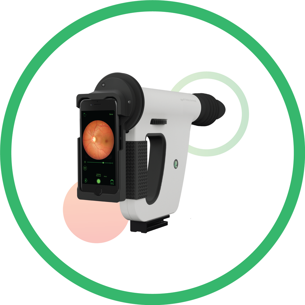 Portable Retinal Screening – FOP NM-10