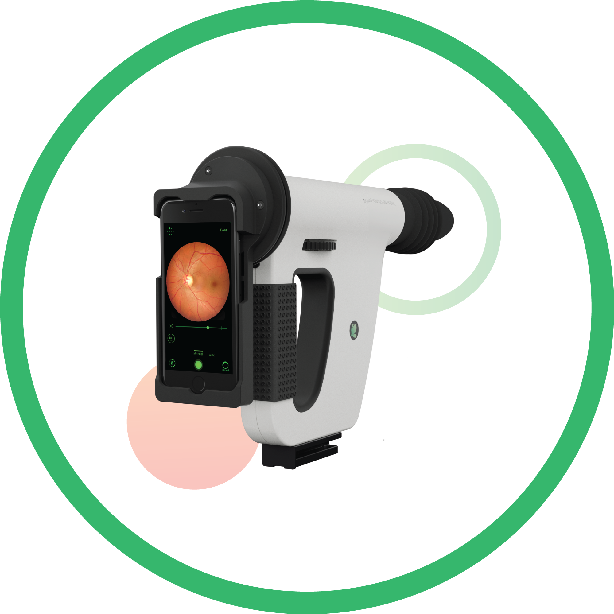 Portable Retinal Screening – FOP NM-10