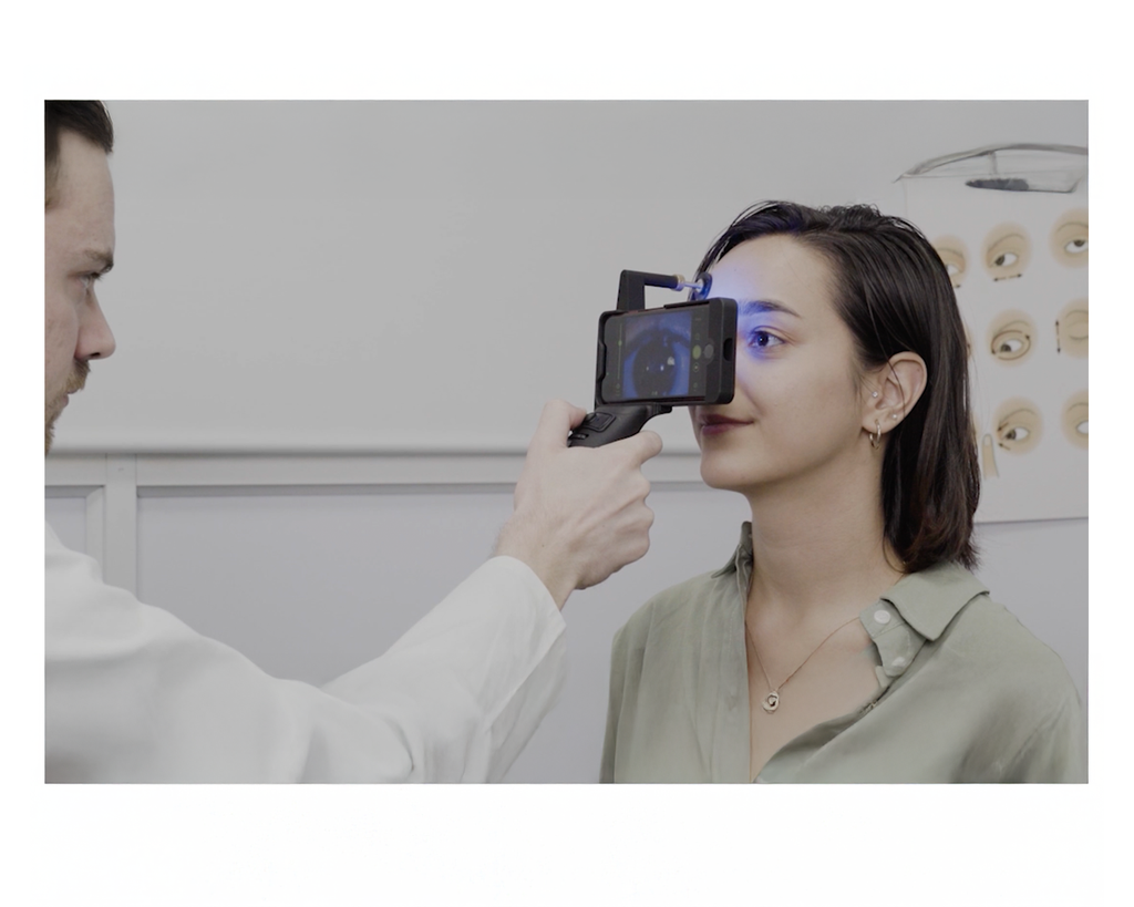 Handheld Digital Slit Lamp - Portable Eye Exam Equipment