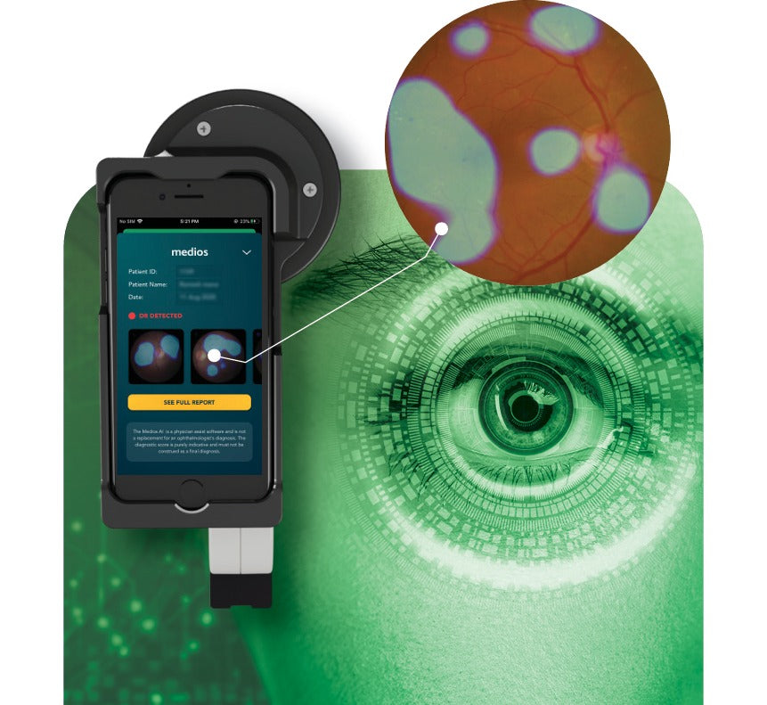 Portable Retinal Screening – FOP NM-10