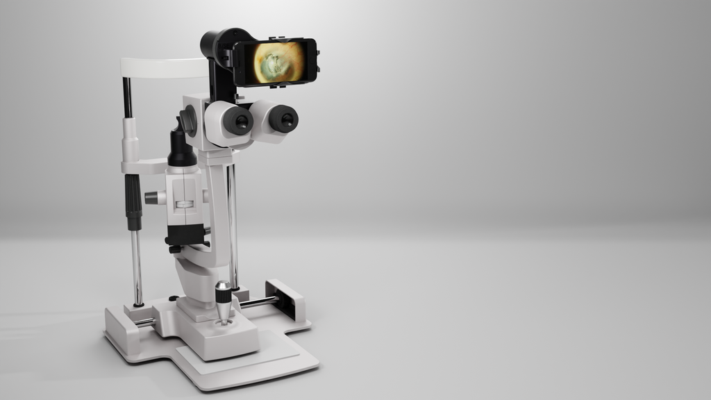 Anterior Imaging Module (AIM)