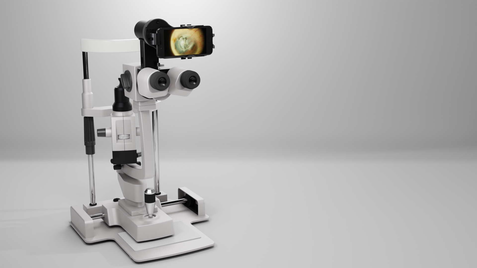 Anterior Imaging Module (AIM)