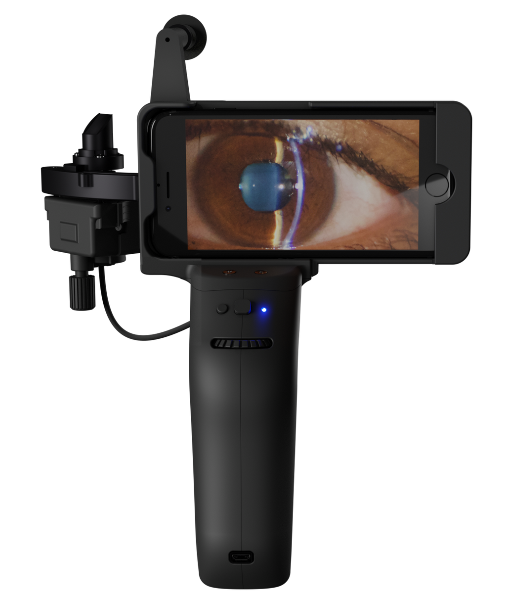 Handheld Digital Slit Lamp - Portable Eye Exam Equipment