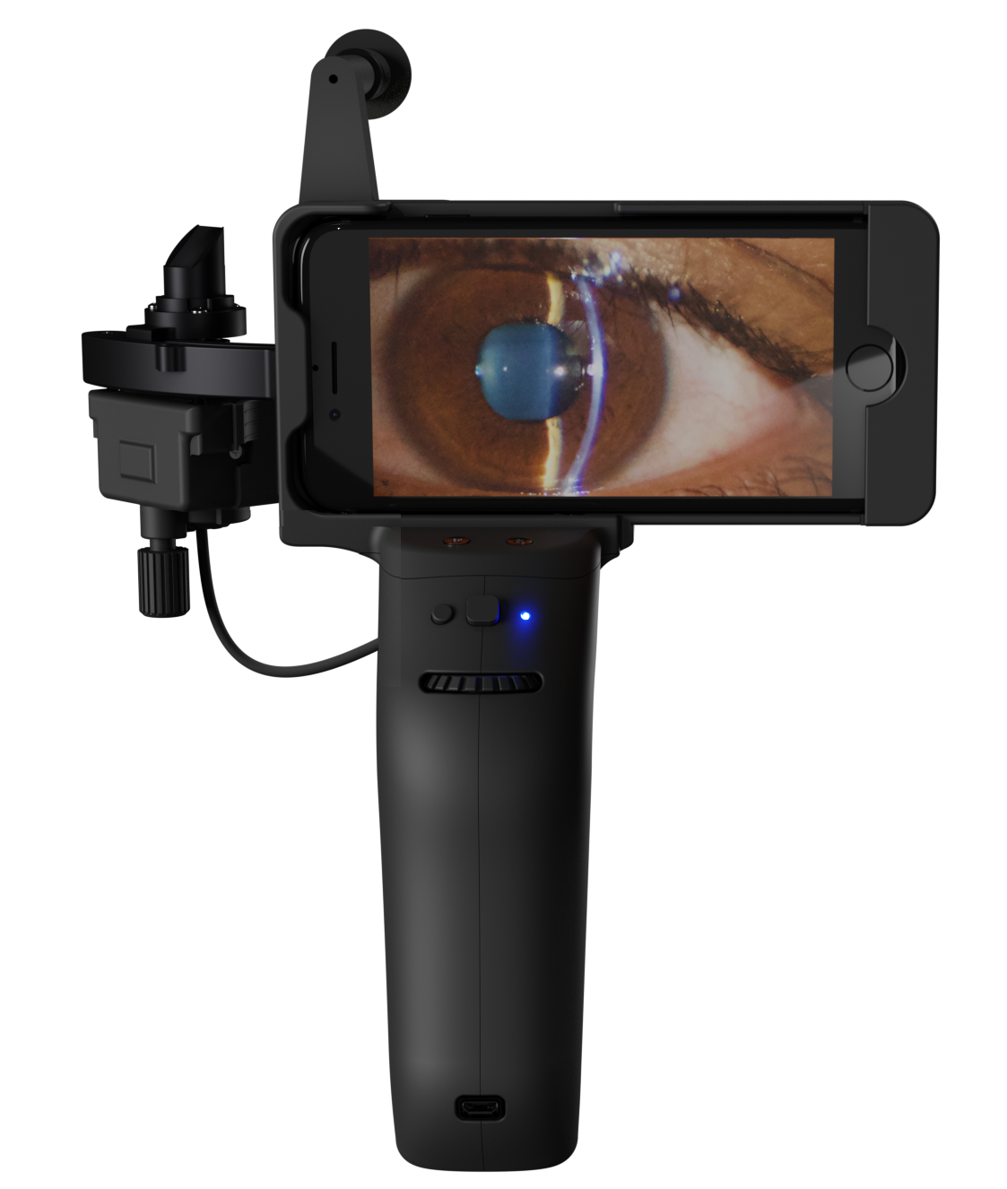 Handheld Digital Slit Lamp - Portable Eye Exam Equipment