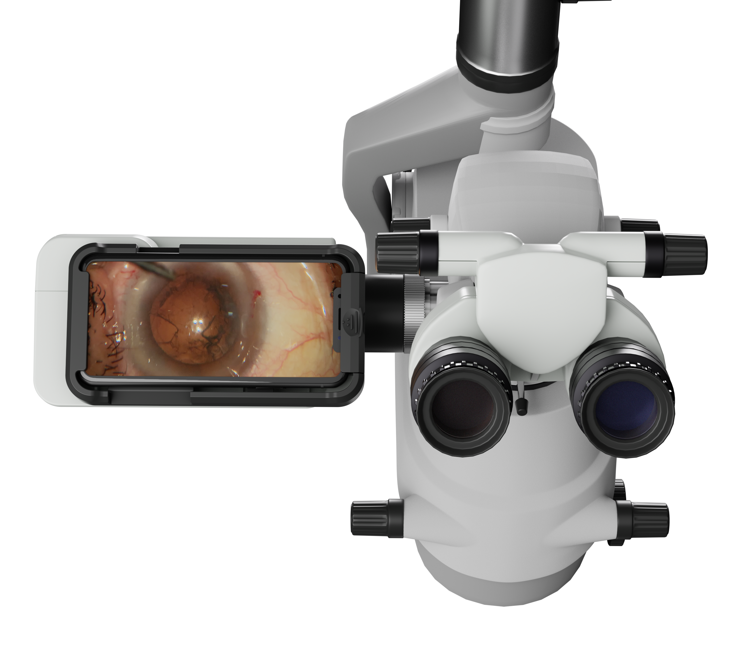 Microscope Recording Device (MRD) – HD Video & Image Capture for Microscopes