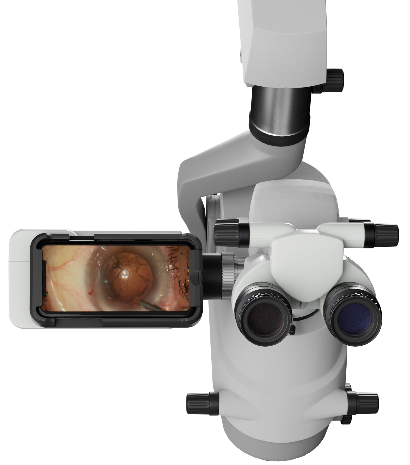 Microscope Recording Device (MRD) – HD Video & Image Capture for Microscopes