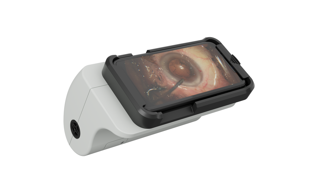 Microscope Recording Device (MRD) – HD Video & Image Capture for Microscopes