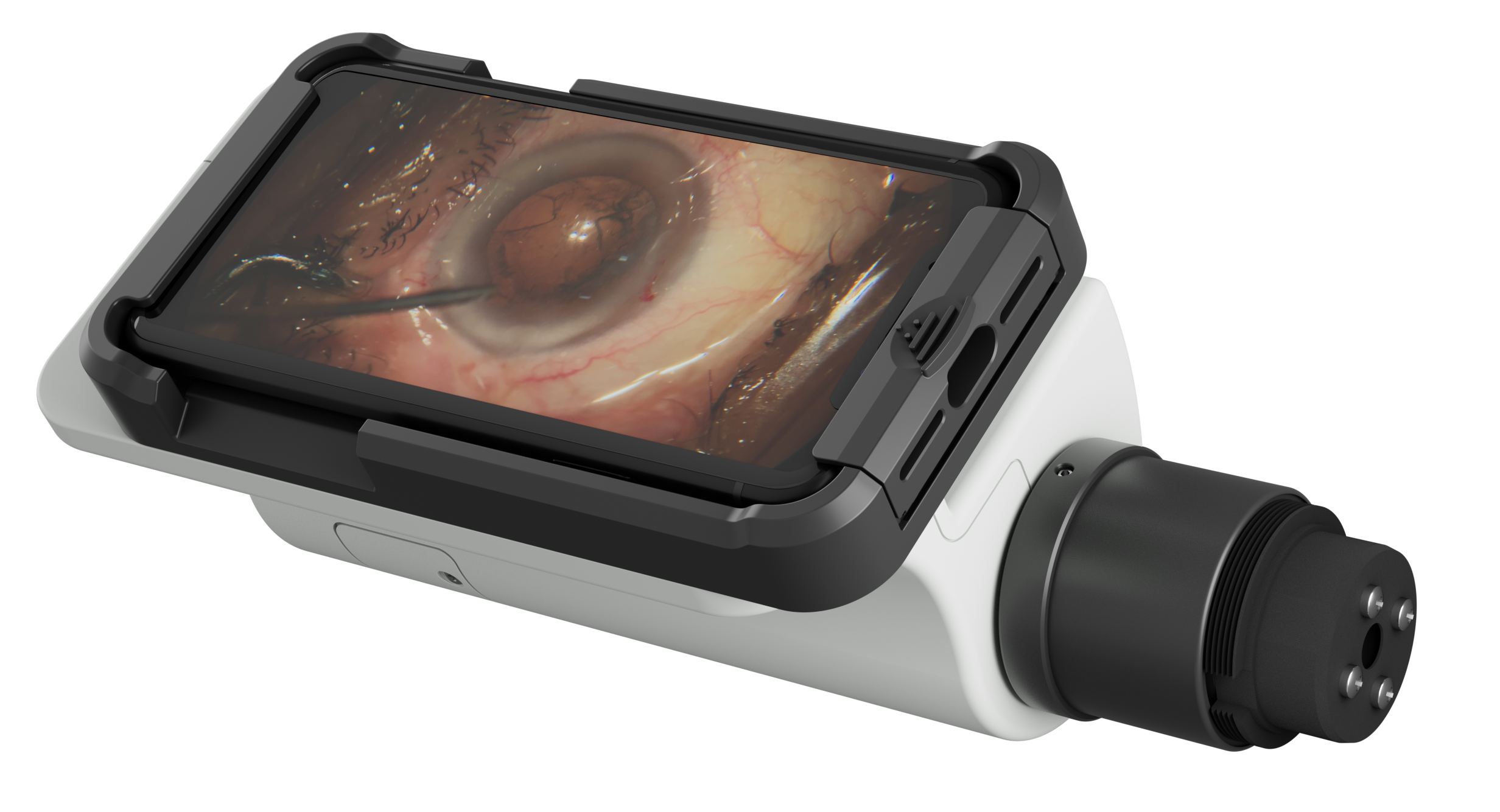 Microscope Recording Device (MRD) – HD Video & Image Capture for Microscopes